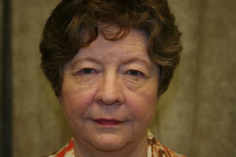 Before 4 Lid Eyelid Lift