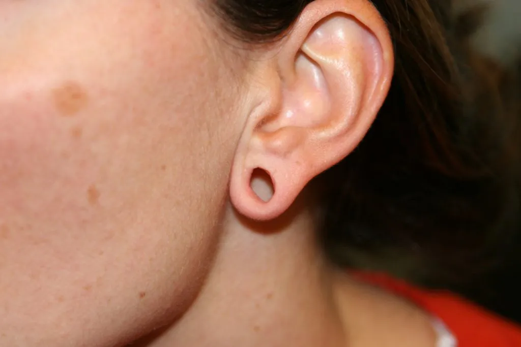 before earlobe repair