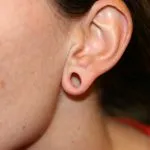 before earlobe repair