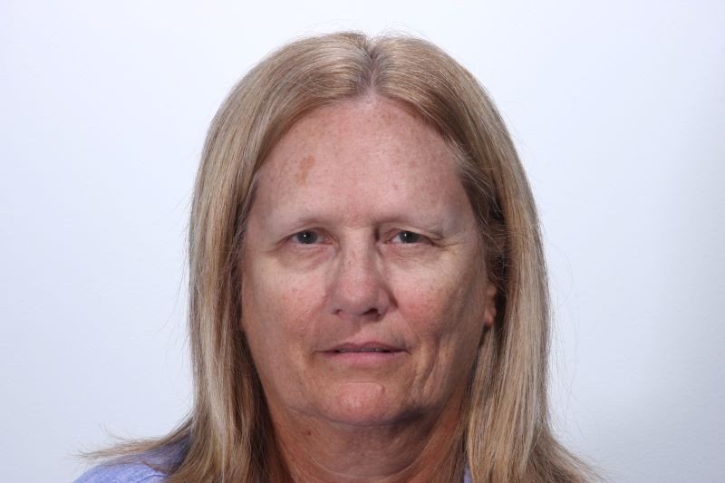 Before Browlift