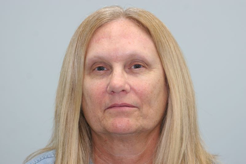 After Browlift