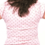 Before Mesolipotherapy 