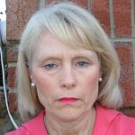 Before the correction of drooping eyelids