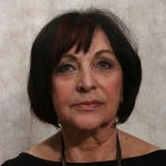 3 years after sculptra