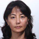 6 years after sculptra