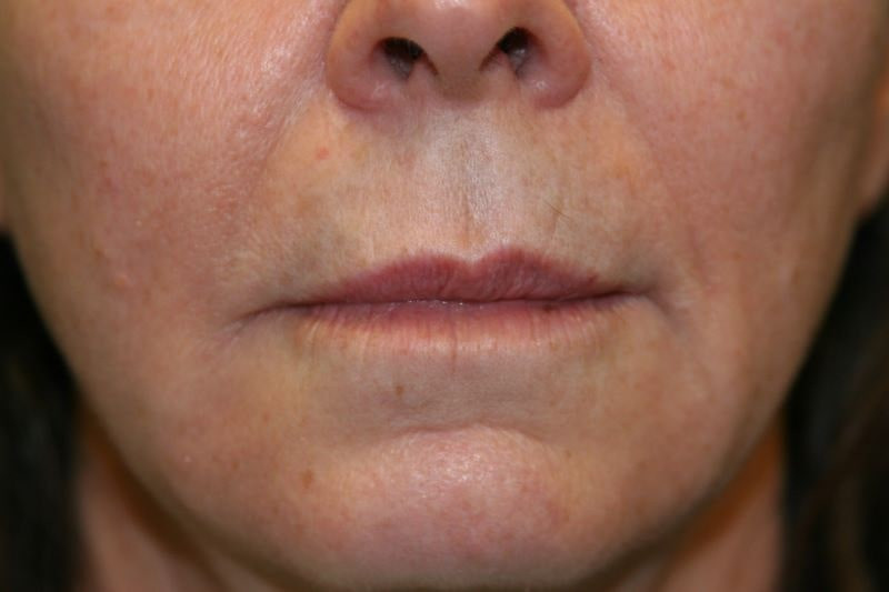 A woman's lips