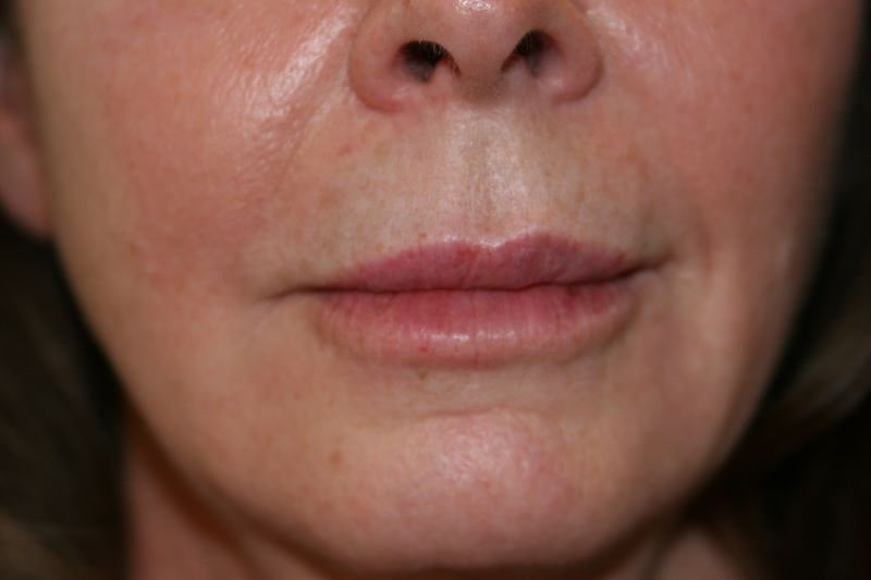 A woman's fuller lips AFTER KYSSE