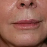 A woman's fuller lips AFTER KYSSE