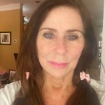 A woman's face after 6 InstaLift Threads