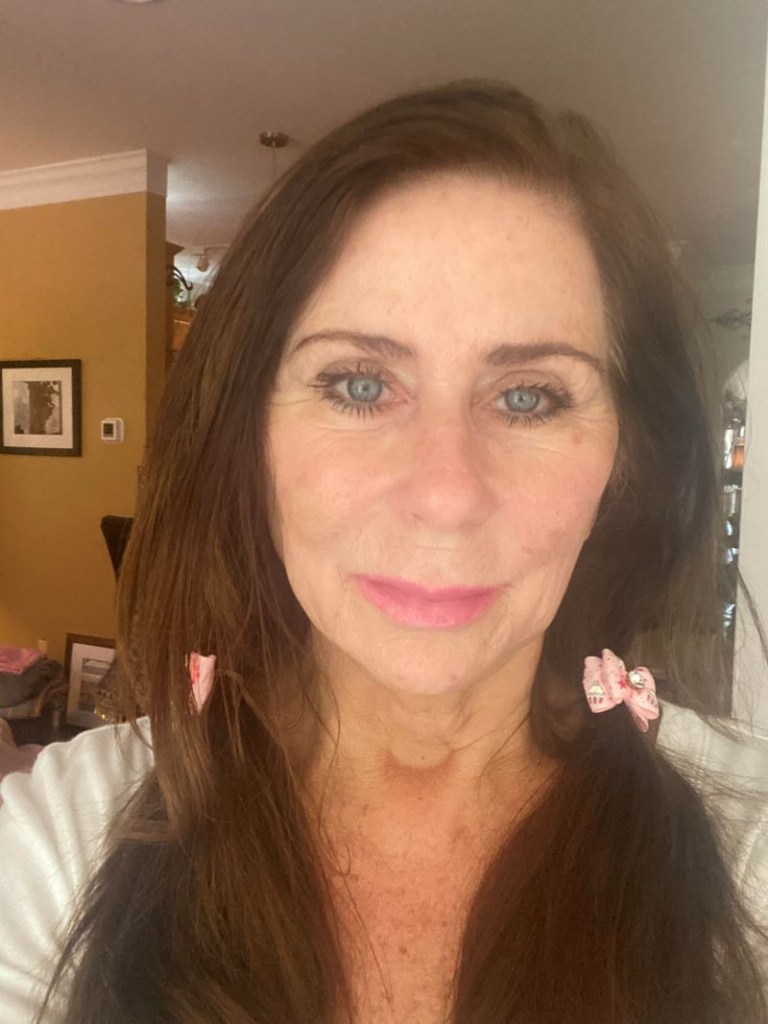 A woman's face after 6 InstaLift Threads