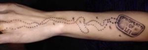 Laser Body Procedures