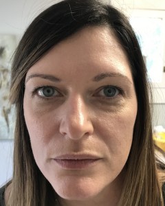 Fillers, Biostimulators