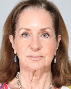 Fillers, Biostimulators
