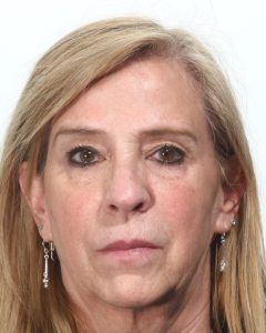 Fillers, Biostimulators