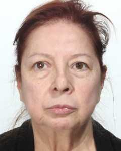 Fillers, Biostimulators