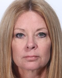 Fillers, Biostimulators